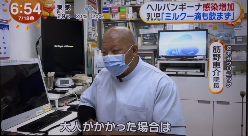 ヘルパンギーナの流行についてのアイキャッチ画像