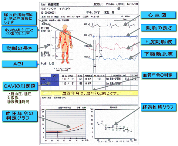 測定結果レポート